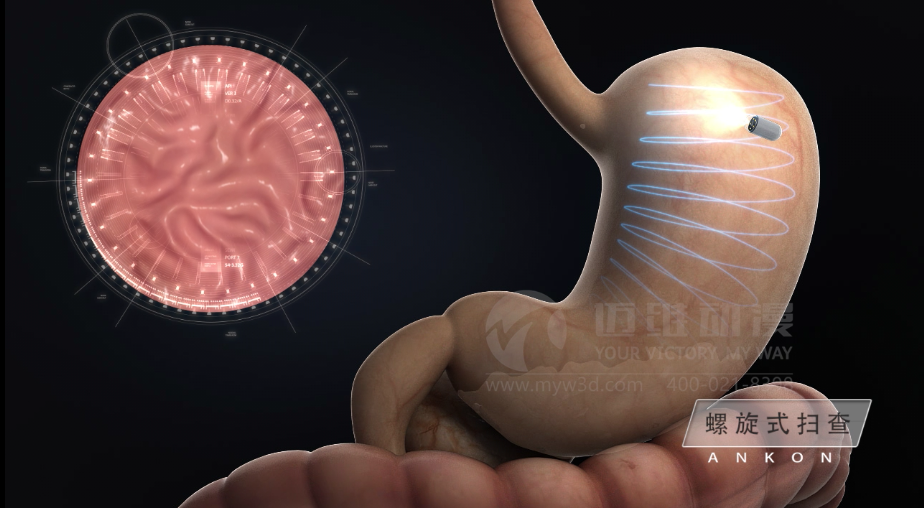 醫(yī)學(xué)醫(yī)療三維動(dòng)畫 醫(yī)學(xué)醫(yī)療三維動(dòng)畫