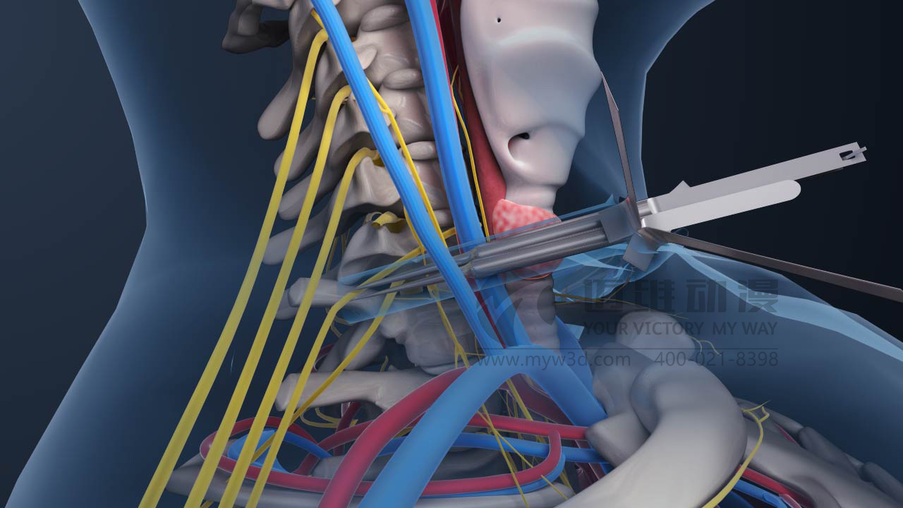 對于醫(yī)療三維動(dòng)畫你會(huì)怎么做？(圖2)