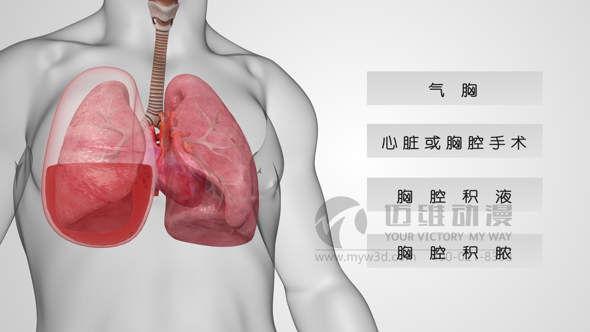 醫(yī)療器械動畫.jpg 醫(yī)療器械動畫.jpg