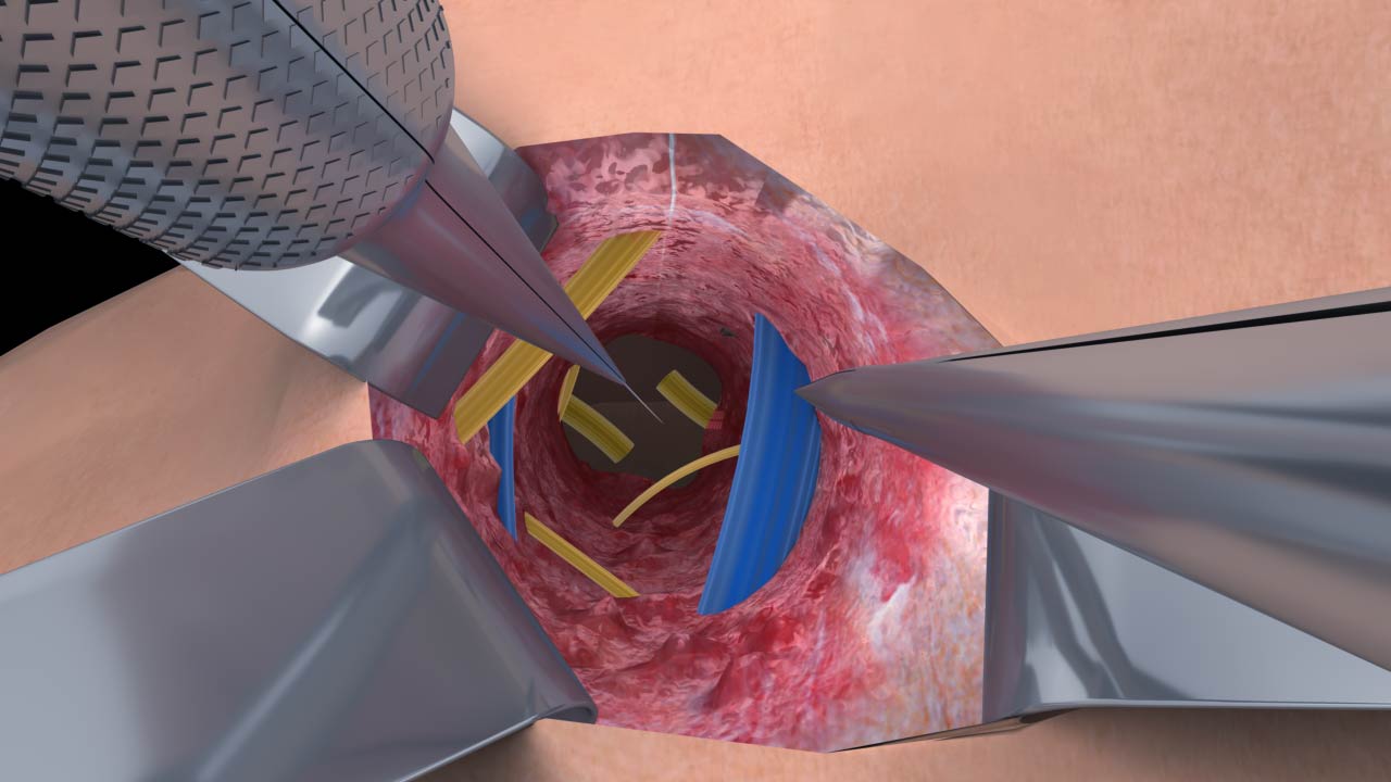 醫(yī)療醫(yī)學(xué)三維動畫.jpg 醫(yī)療醫(yī)學(xué)三維動畫.jpg