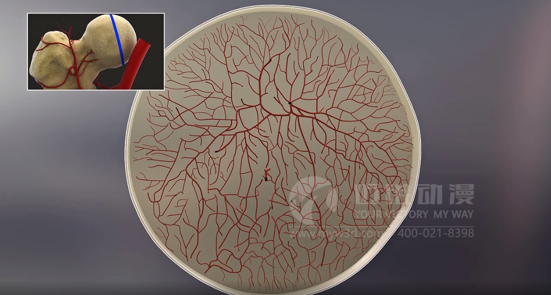 醫(yī)學(xué)醫(yī)療行業(yè)為什么青睞于三維動(dòng)畫？(圖5)