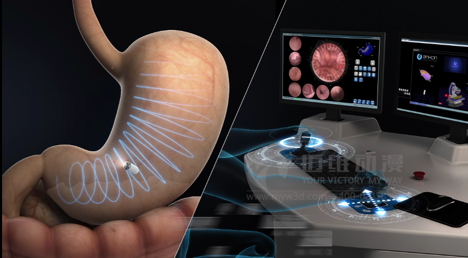 醫(yī)用設(shè)備三維動(dòng)畫制作好處有哪些？(圖3)