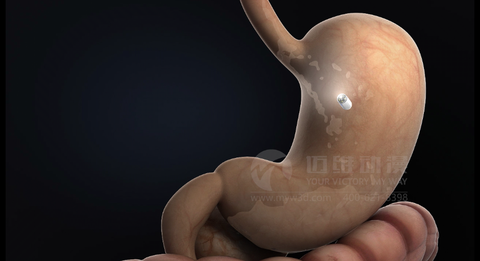 醫(yī)用設(shè)備三維動(dòng)畫制作好處有哪些？(圖1)