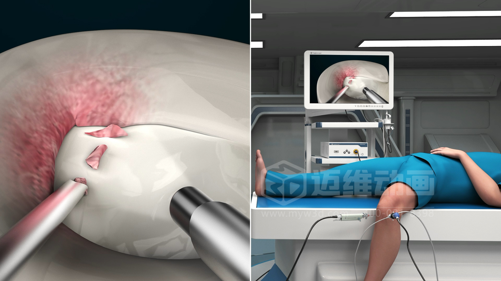 三維動畫制作在展現(xiàn)醫(yī)療器械方面能給企業(yè)帶來諸多優(yōu)勢，這5點不容忽視！(圖3)