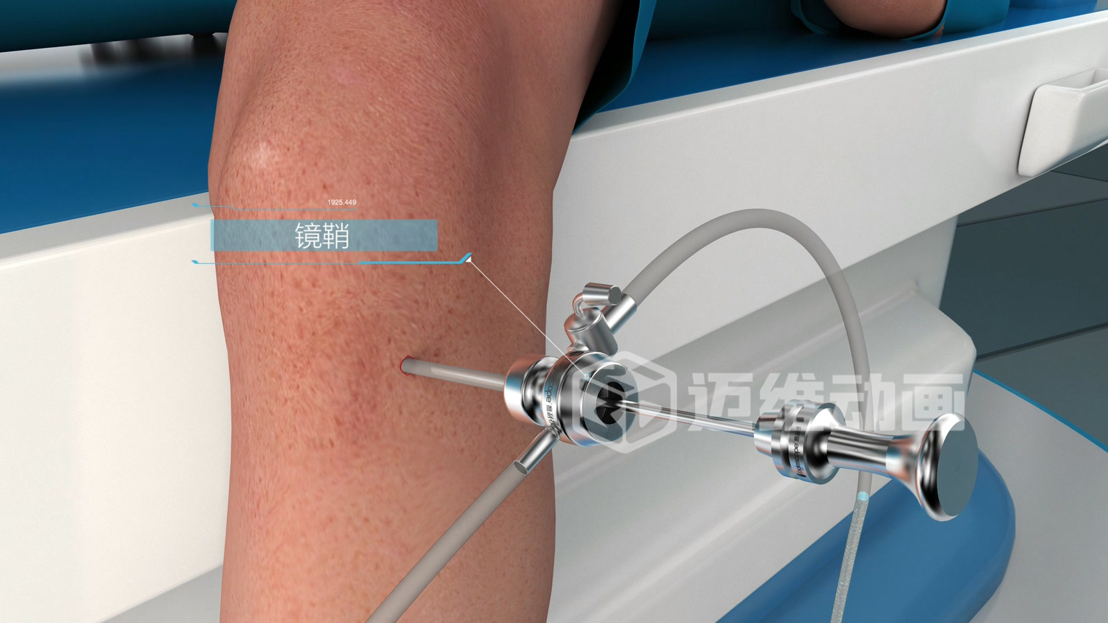 關(guān)節(jié)鏡手術(shù)三維動畫