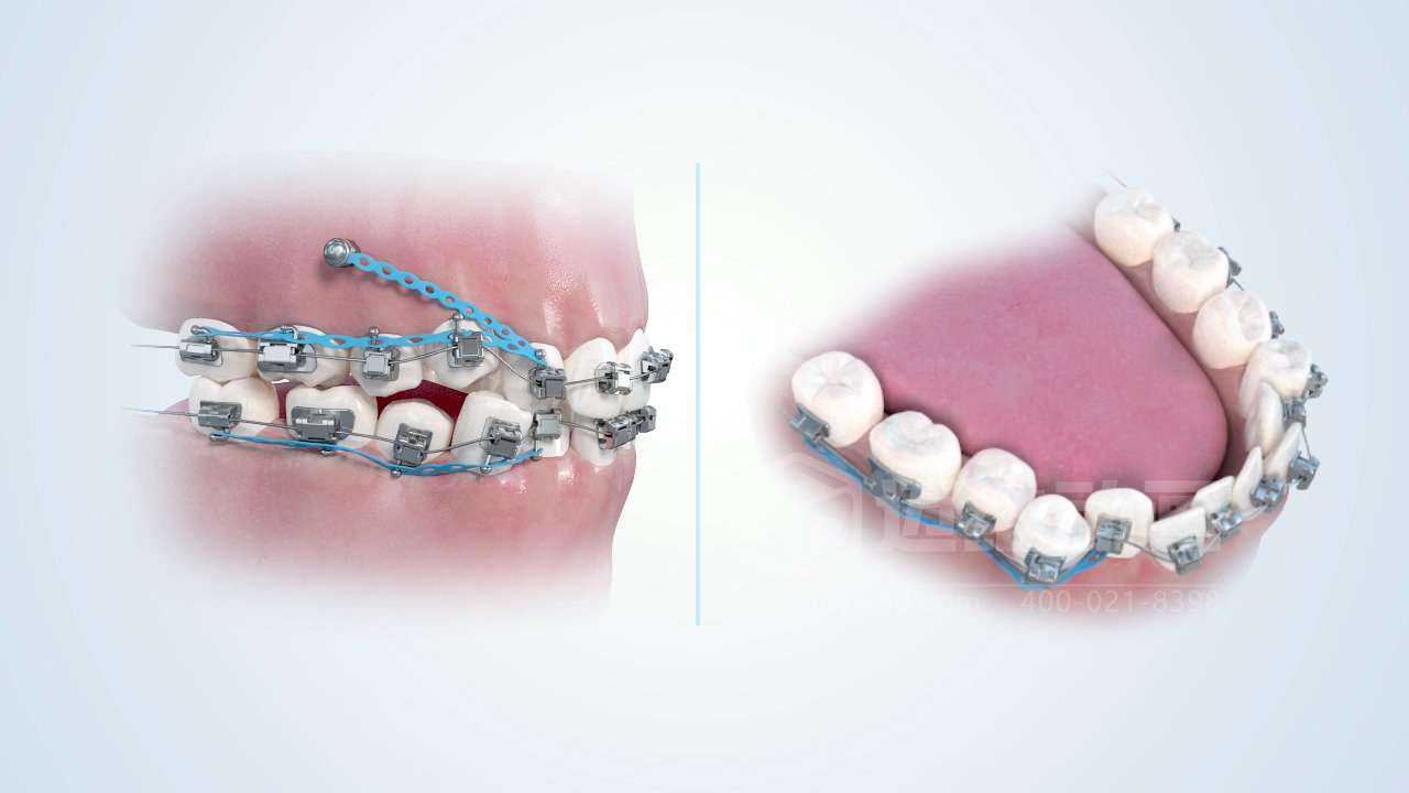 從實驗室到手術(shù)室：邁維動漫用三維動畫，讓精密科技“看得見，懂得到”訂單轉(zhuǎn)化率提高 50%(圖10)