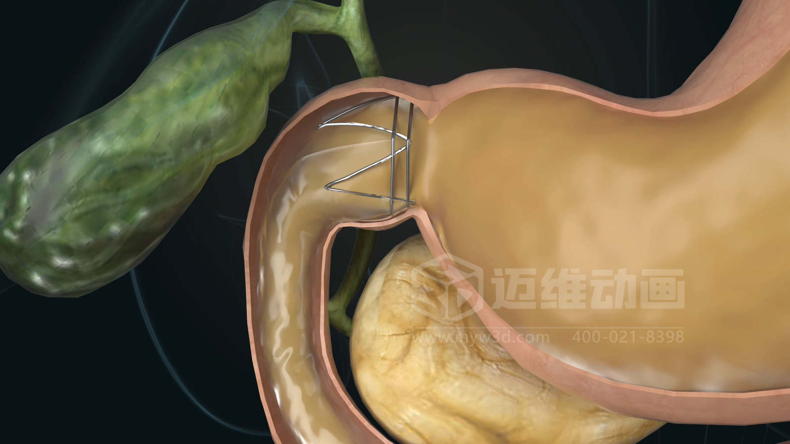 從實驗室到手術(shù)室：邁維動漫用三維動畫，讓精密科技“看得見，懂得到”訂單轉(zhuǎn)化率提高 50%(圖11)