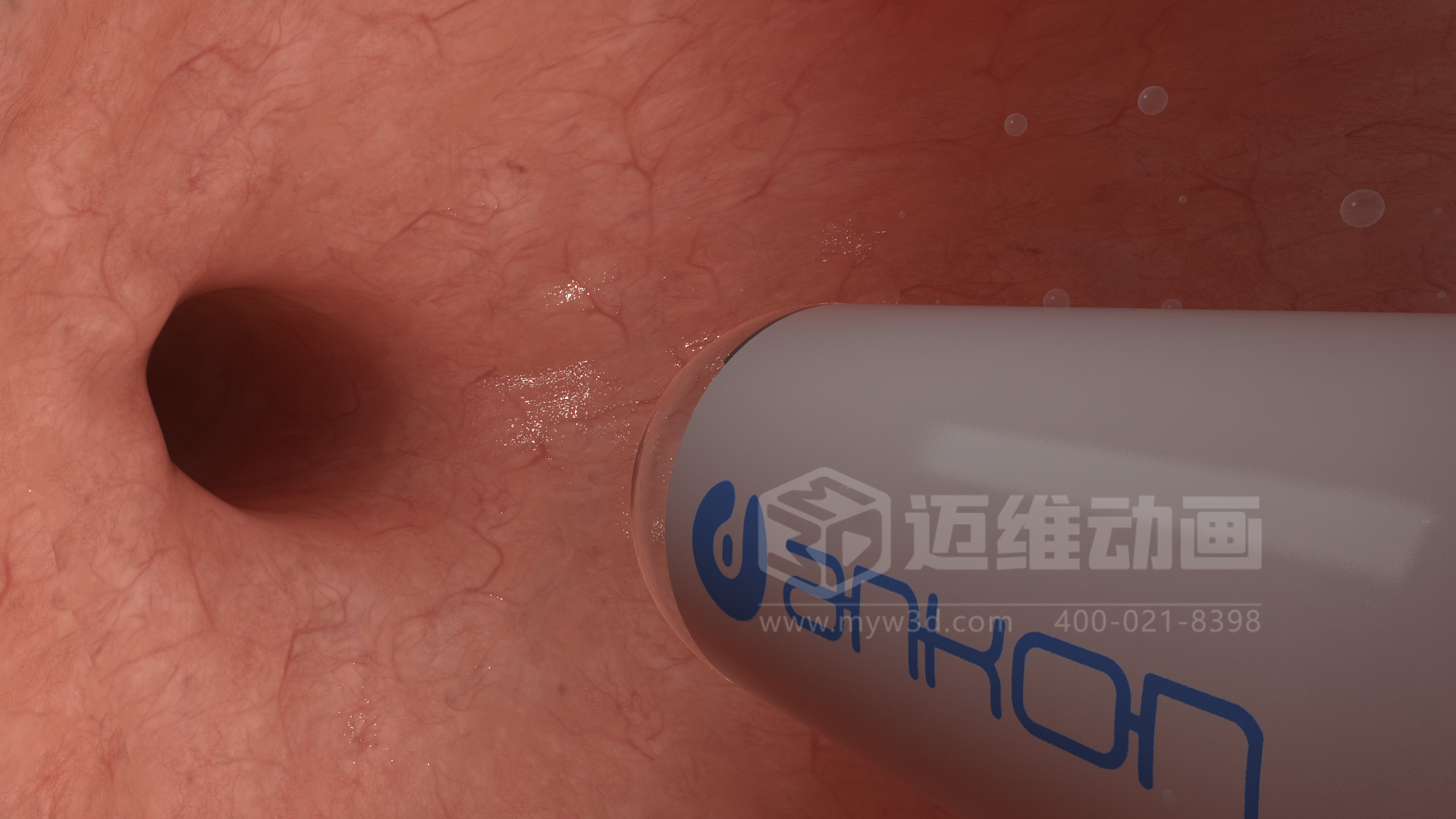 醫(yī)學(xué)檢測設(shè)備如何突破消化道檢查壁壘？三維動畫還原核心技術(shù)與臨床價值(圖4)