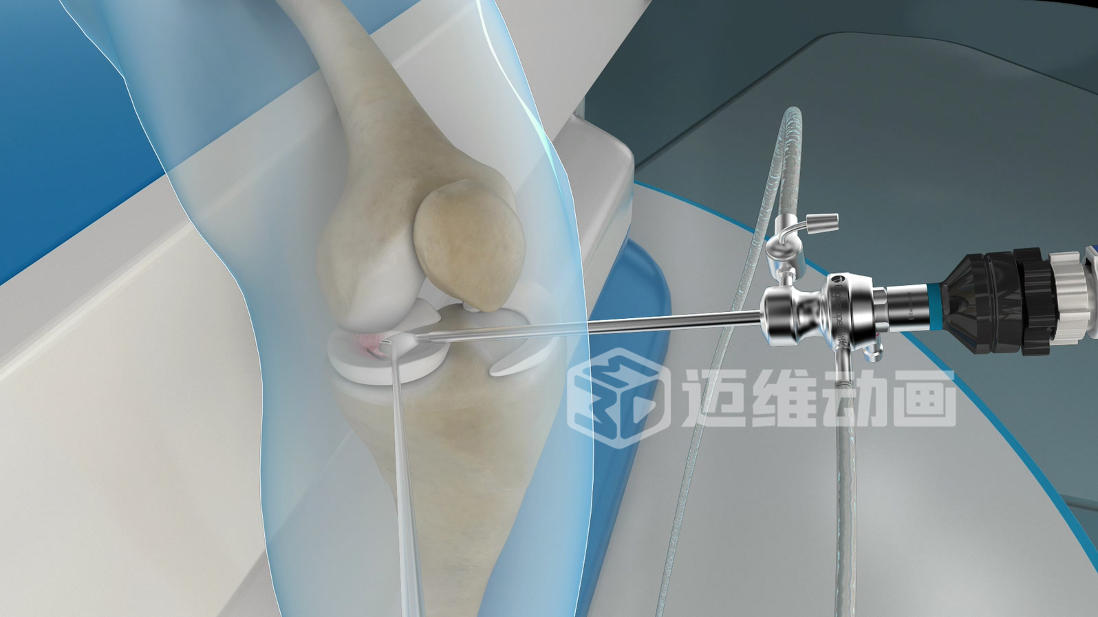 從 “看不懂” 到 “秒懂”，醫(yī)學(xué)醫(yī)療三維動畫憑什么兼顧專業(yè)度與傳播力？(圖1)