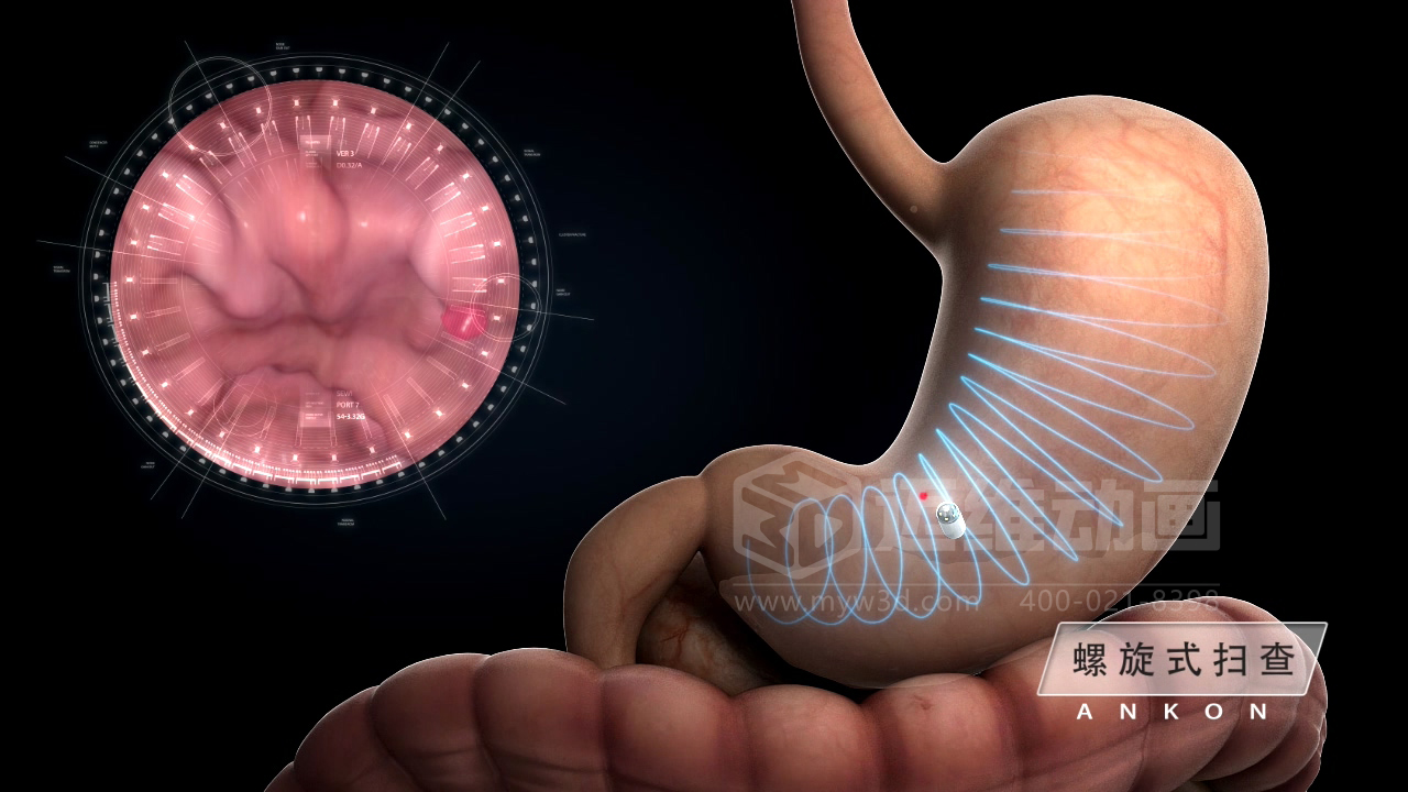 從 “看不懂” 到 “秒懂”，醫(yī)學(xué)醫(yī)療三維動畫憑什么兼顧專業(yè)度與傳播力？(圖5)